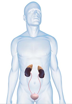 Urología en Móstoles - Clínica Inresa